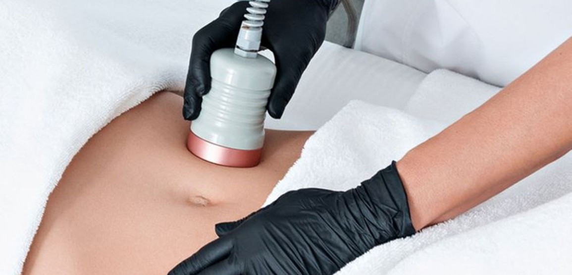 Cavitation